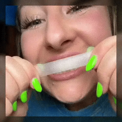 KIT BLANCHIMENT DENTAIRE ICEPEARL